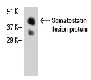 Somatostatin (D-20): sc-7819. Western blot analysis of human recombinant Somatostatin fusion protein.