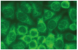 HSP 105 (B-7): sc-74550. Immunofluorescence staining of methanol-fixed HeLa cells showing cytoplasmic localization.