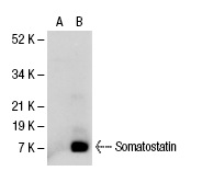 Somatostatin (D-20): sc-7819. Western blot analysis of Somatostatin expression in non-transfected: sc-110760 (A) and human Somatostatin transfected: sc-110762 (B) 293 whole cell lysates.