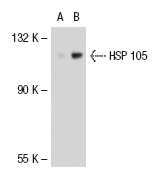 HSP 105 (M-20): sc-1804. Western blot analysis of HSP 105 expression in non-transfected: sc-117752 (A) and human HSP 105 transfected: sc-114818 (B) 293T whole cell lysates.