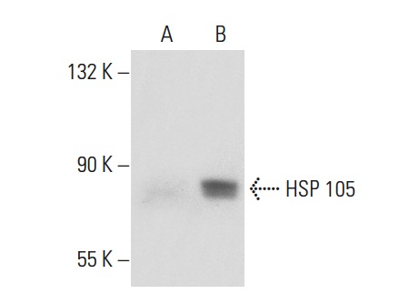 HSP 105 (M-20): sc-1804. Western blot analysis of HSP 105 expression in non-transfected: sc-117752 (A) and human HSP 105 transfected: sc-175399 (B) 293T whole cell lysates.