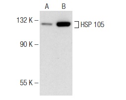 HSP 105 (M-20): sc-1804. Western blot analysis of HSP 105 expression in untreated (A) and Lactacystin (sc-3575) treated (B) C6 whole cell lysates. Note upregulation of HSP 105 expression in lane B.