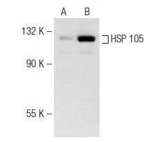 HSP 105 (N-187): sc-6241. Western blot analysis of HSP 105 expression in untreated (A) and Lactacystin (sc-3575) treated (B) C6 whole cell lysates. Note upregulation of HSP 105 expression in lane B.