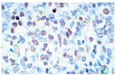 IFI-16 (1G7): sc-8023. Immunoperoxidase staining of formalin-fixed, paraffin-embeded normal humal tonsil showing nuclear localization.