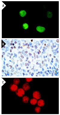 IFI-16 (1G7): sc-8023. Immunofluorescence staining of methanol-fixed Jurkat cells (A), immunoperoxidase staining of formalin-fixed, paraffin-embedded normal human tonsil (B) and immunofluorescence staining of methanol-fixed BJAB cells (C) showing nuclear localization.
