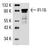 IFI-16 (C-18): sc-6050. Western blot analysis of IFI-16 expression in Jurkat nuclear extract.