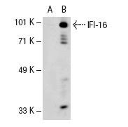 IFI-16 (C-18): sc-6050. Western blot analysis of IFI-16 expression in non-transfected: sc-110760 (A) and human IFI-16 transfected: sc-113241 (B) whole cell lysates.