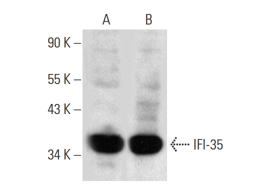IFI-35 (39.287): sc-100769. Western blot analysis of IFI-35 expression in HeLa (A) and HL-60 (B) whole cell lysates.