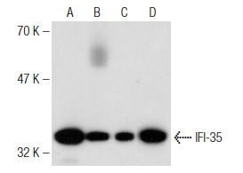 IFI-35 (39.287): sc-100769. Western blot analysis of IFI-35 expression in A-431 (A), HL-60 (B), HeLa (C) and Jurkat (D) whole cell lysates.