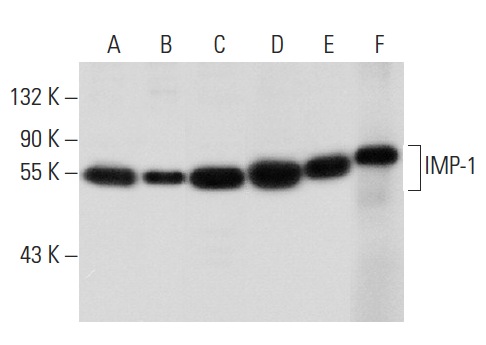 IMP-1 (D-9): sc-166344. Western blot analysis of IMP-1 expression in HEK293 (A), NIH/3T3 (B), K-562 (C), U-698-M (D) and Raji (E) whole cell lysates and mouse thymus tissue extract (F).