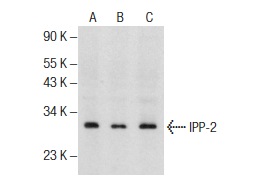 IPP-2 (I-20): sc-14265. Western blot analysis of IPP-2 expression in Jurkat (A), MES-SA/Dx5 (B) and Raji (C) whole cell lysates.