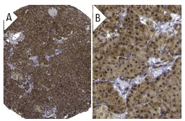 IRE1α (H-190): sc-20790. Immunoperoxidase staining of formalin fixed, paraffin-embedded human pancreas tissue showing cytoplasmic staining of exocrine pancreas and islet cells at low (A) and high (B) magnification. Kindly provided by The Swedish Human Protein Atlas (HPA) program.
