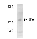 IRE1α (H-190): sc-20790. Western blot analysis of IRE1α expression in DU 145 whole cell lysate.