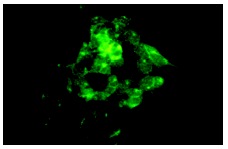 IRE1α (H-190): sc-20790. Immunofluorescence staining of methanol-fixed IMR-32 cells showing cytoplasmic localization.