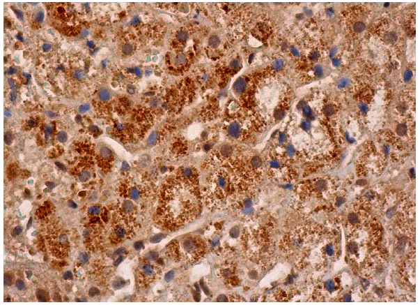 ISG15 (H-150): sc-50366. Immunoperoxidase staining of formalin fixed, paraffin-embedded human adrenal gland tissue showing cytoplasmic staining of glandular cells.