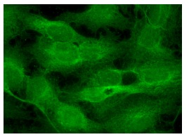 KLHL9/13 (D-4): sc-166486. Immunofluorescence staining of formalin-fixed Hep G2 cells showing cytoplasmic and nuclear localization.