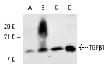 TGFβ1 (V)-G: sc-146-G. Western blot analysis of TGFβ1 expression in rat adrenal (A) and mouse uterus (B) extracts and MCF7 (C) and T-47D (D) whole cell lysates.