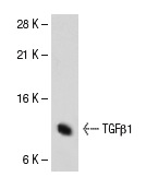 TGFβ1 (V): sc-146. Western blot analysis of TGFβ1 expression in 293T whole cell lysate.