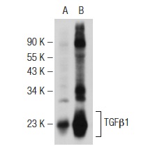 TGFβ1 (V): sc-146. Western blot analysis of TGFβ1 expression in rat adrenal gland (A) and mouse uterus (B) tissue extracts.