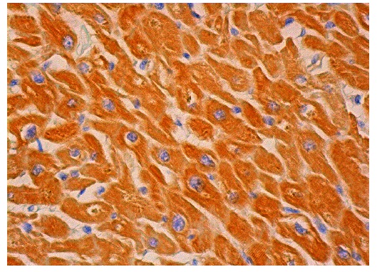 LDH-D (G-8): sc-374127. Immunoperoxidase staining of formalin fixed, paraffin-embedded human heart muscle tissue showing cytoplasmic staining of myocytes.