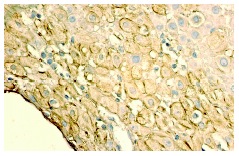 TGFβ2 (V): sc-90. Immunoperoxidase staining of formalin fixed, paraffin-embedded human placenta tissue showing cytoplasmic and extracellular localization.