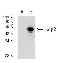 TGFβ2 (V): sc-90. Western blot analysis of TGFβ2 expression in non-transfected: sc-117752 (A) and mouse TGFβ2 transfected: sc-124019 (B) 293T whole cell lysates.