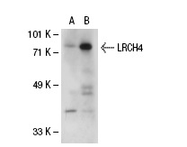 LRCH4 (D-20): sc-51421. Western blot analysis of LRCH4 expression in non-transfected: sc-110760 (A) and human LRCH4 transfected: sc-113267 (B) 293 whole cell lysates.