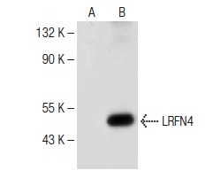 LRFN4 (P-12): sc-138392. Western blot analysis of LRFN4 expression in non-transfected: sc-117752 (A) and human LRFN4 transfected: sc-114528 (B) 293T whole cell lysates.