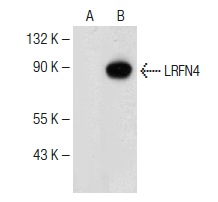 LRFN4 (P-12): sc-138392. Western blot analysis of LRFN4 expression in non-transfected: sc-117752 (A) and mouse LRFN4 transfected: sc-121393 (B) 293T whole cell lysates.