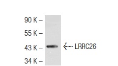 LRRC26 (V-19): sc-102015. Western blot analysis of LRRC26 expression in Jurkat whole cell lysate.