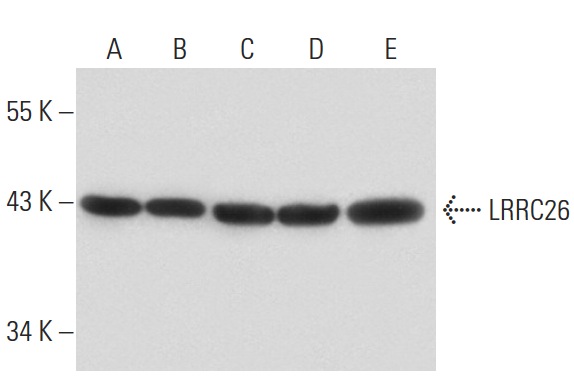 LRRC26 (V-19): sc-102015. Western blot analysis of LRRC26 expression in non-transfected 293T: sc-117752 (A), mouse LRRC26 transfected 293T: sc-110187 (B), Jurkat (C), LADMAC (D) and KNRK (E) whole cell lysates.