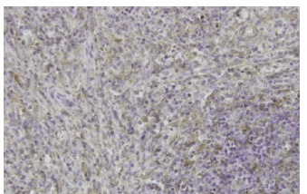 MARCKS (JK-8): sc-100777. Immunoperoxidase staining of formalin-fixed, paraffin-embedded human spleen tissue showing cytoplasmic localization.