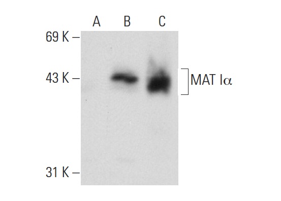 MAT I&alpha (V-15): sc-28029. Western blot analysis of MAT Iα expression in non-transfected 293T: sc-117752 (A), human MAT Iα transfected 293T: sc-170529 (B) and Hep G2 (C) whole cell lysates.