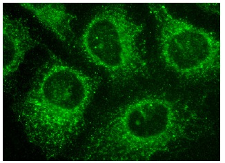 MAT Iα (V-15): sc-28029. Immunofluorescence staining of methanol-fixed HeLa cells showing cytoplasmic localization.