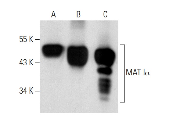 MAT Iα/IIα (B-10): sc-166452. Western blot analysis of MAT Iα expression in non-transfected 293T: sc-117752 (A), human MAT Iα transfected 293T: sc-170529 (B) and HeLa (C) whole cell lysates.