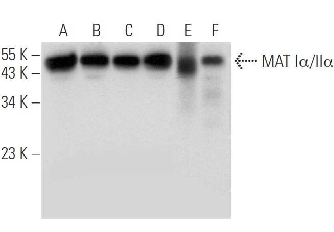 MAT Iα/IIα (B-10): sc-166452. Western blot analysis of MAT Iα/IIα expression in HeLa (A), Ramos (B) and PC-12 (C) whole cell lysates, HeLa nuclear extract (D) and human kidney (E) and human lung (F) tissue extracts.