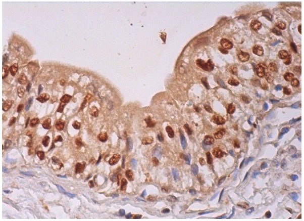 MAT Iα/IIα (H-300): sc-32929. Immunoperoxidase staining of formalin fixed, paraffin-embedded human urinary bladder tissue showing cytoplasmic and nuclear staining of urothelial cells.