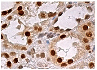MAT I/II/III (A-10): sc-166183. Immunoperoxidase staining of formalin fixed, paraffin-embedded human kidney tissue showing nuclear and cytoplasmic staining of cells in tubules.