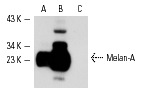 Melan-A (A103): sc-20032. Western blot analysis of Melan-A expression in C32 (A), SK-MEL-28 (B) and SK-MEL-24 (C) whole cell lysates.