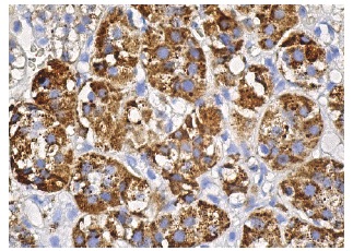 Melan-A (A103): sc-20032. Immunoperoxidase staining of formalin fixed, paraffin-embedded human adrenal gland tissue showing cytoplasmic staining of glandular cells.