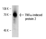 TNFα-IP 2 (F-6): sc-28318. Western blot analysis of TNFα-induced protein 2 expression in TNFα-induced protein 2-transfected HEK 293 cells.