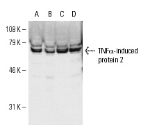 TNFα-IP 2 (F-6): sc-28318. Western blot analysis of TNFα-induced protein 2 expression in U-937 (A), TNFα-induced U-937 (B), K-562 (C) and AML-193 (D) whole cell lysates.