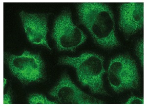 MetAP-2 (F-7): sc-365637. Immunofluorescence staining of methanol-fixed HeLa cells showing cytoplasmic localization.