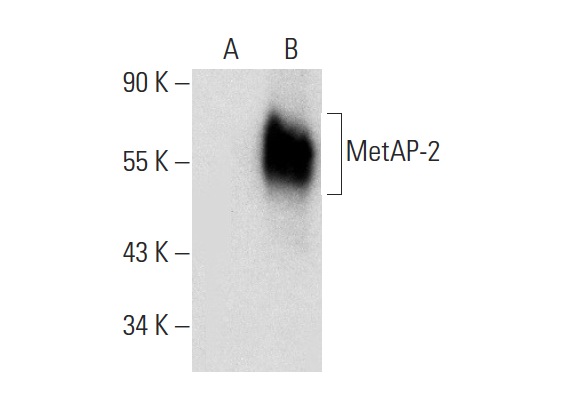 MetAP-2 (F-7): sc-365637. Western blot analysis of MetAP-2 expression in non-transfected: sc-117752 (A) and mouse MetAP-2 transfected: sc-121610 (B) 293T whole cell lysates.