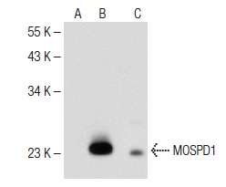 MOSPD1 (N-14): sc-138437. Western blot analysis of MOSPD1 expression in non-transfected 293T: sc-117752 (A), mouse MOSPD1 transfected 293T: sc-121721 (B) and SW480 (C) whole cell lysates.