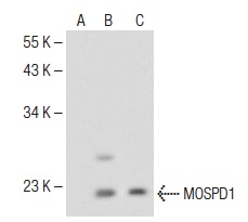 MOSPD1 (N-14): sc-138437. Western blot analysis of MOSPD1 expression in non-transfected 293T: sc-117752 (A), human MOSPD1 transfected 293T: sc-171352 (B) and SW480 (C) whole cell lysates.
