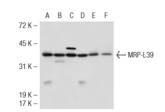 MRP-L39 (D-16): sc-83300. Western blot analysis of MRP-L39 expression in HEK293 (A), Hep G2 (B), SK-BR-3 (C), NTERA-2 cl.D1 (D), U-937 (E) and MOLT-4 (F) whole cell lysates.