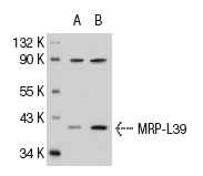 MRP-L39 (I-19): sc-83301. Western blot analysis of MRP-L39 expression in non-transfected: sc-117752 (A) and mouse MRP-L39 transfected: sc-121768 (B) 293T whole cell lysates.