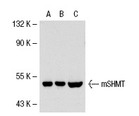 mSHMT (C-20): sc-25064. Western blot analysis of mSHMT expression in non-transfected 293T: sc-117752 (A), human mSHMT transfected 293T: sc-115247 (B) and A-673 (C) whole cell lysates.
