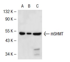 mSHMT (C-20): sc-25064. Western blot analysis of mSHMT expression in non-transfected 293T: sc-117752 (A), mouse mSHMT transfected 293T: sc-121799 (B) and MCF7 (C) whole cell lysates.